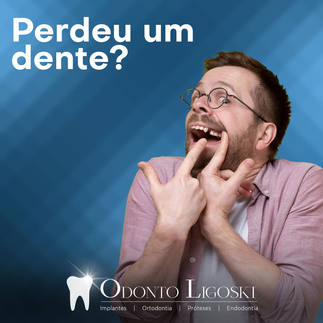 Perdeu um dente?