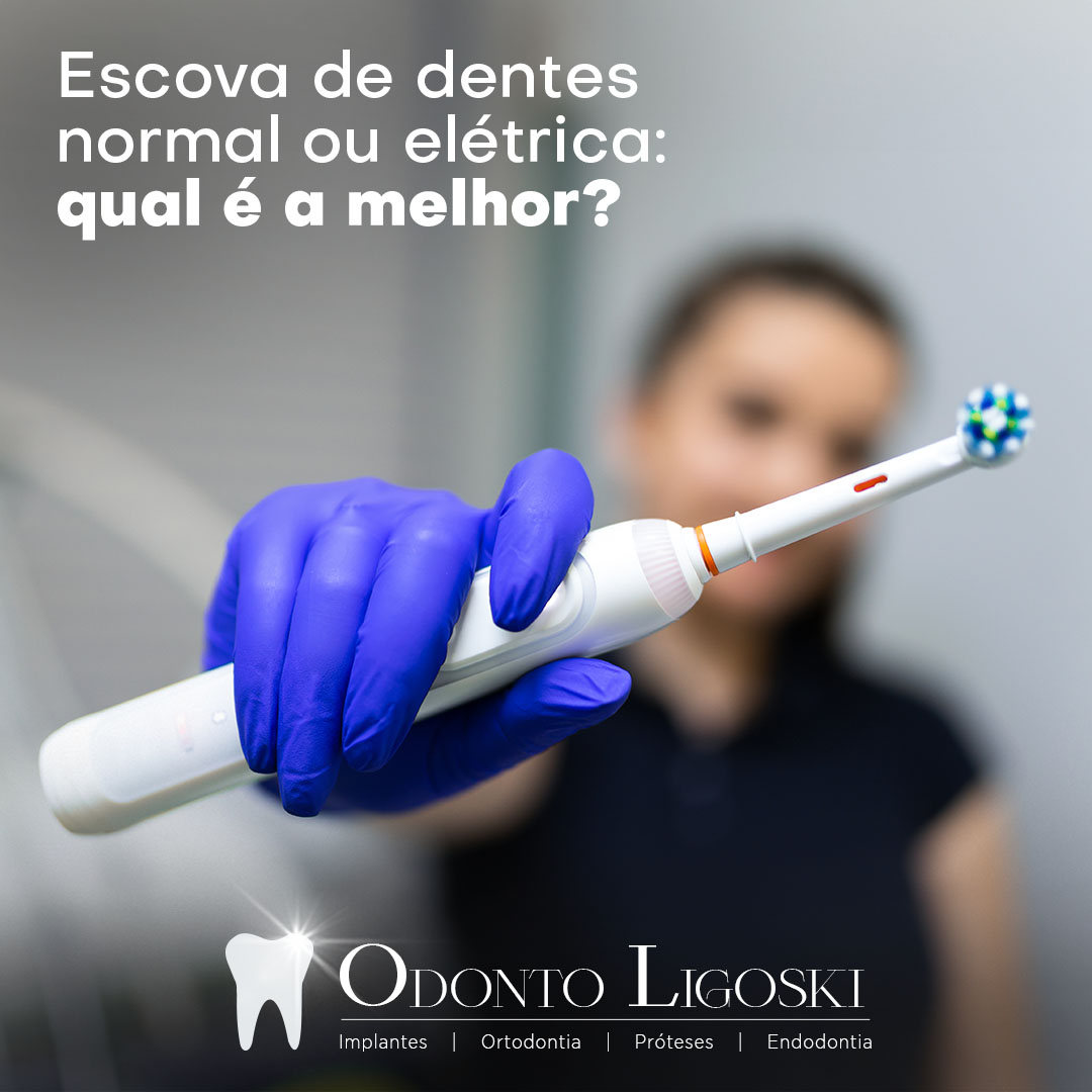 Escova de dentes normal ou elétrica: Qual é a melhor?