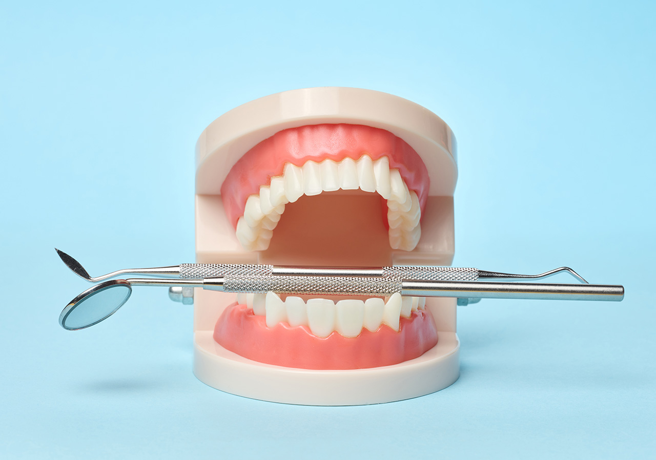 O Que é Tártaro nos Dentes e Como Evitá-lo: Um Guia Completo para a Sua Saúde Bucal