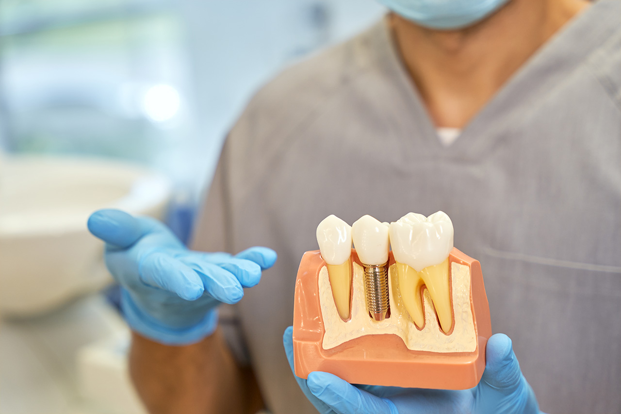 A Solução Definitiva: Como os Implantes Dentários Devolvem a Alegria de Sorrir